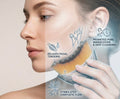 Quorava LymphLift™